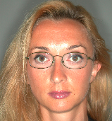 Dr. Simonetta Meuli